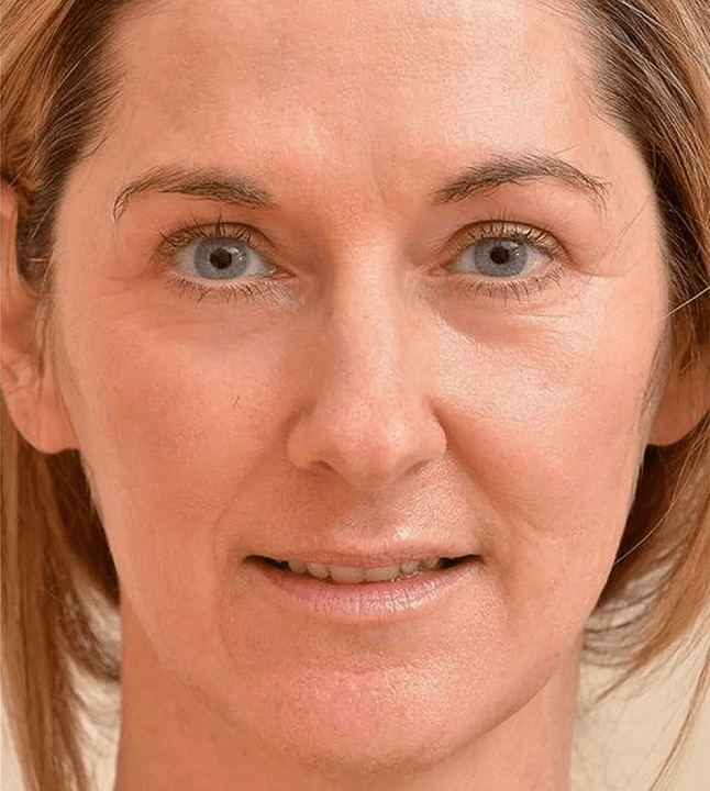 I look younger after applying the Eudalie cream