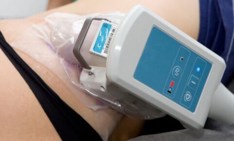 cryolipolysis for body skin